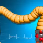 Il Megacolon tossico