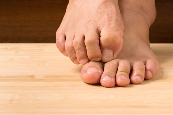 L'Osteomielite: cosa è, come si cura